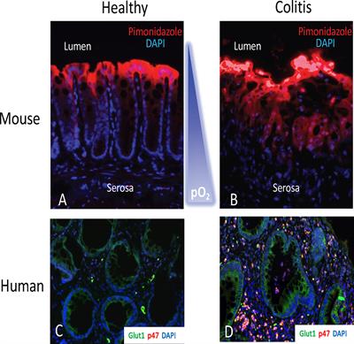 The hypoxic tissue microenvironment as a driver of mucosal inflammatory resolution